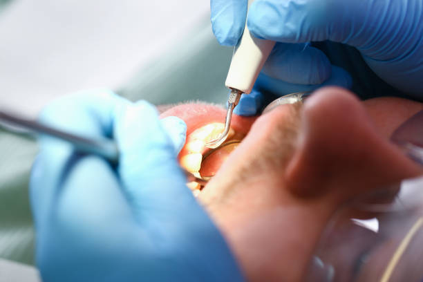 Best Emergency Treatment for Jaw Pain or Injury in Estes Park, CO